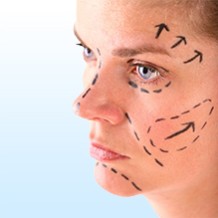 face-surgery by Dr. Sultan